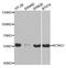 Potassium voltage-gated channel subfamily KQT member 1 antibody, PA5-37420, Invitrogen Antibodies, Western Blot image 