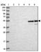 Amidohydrolase Domain Containing 2 antibody, NBP1-84515, Novus Biologicals, Western Blot image 