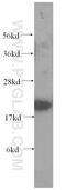 RAB18, Member RAS Oncogene Family antibody, 60057-1-Ig, Proteintech Group, Western Blot image 
