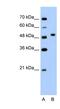 Proline Rich 5 Like antibody, NBP1-57688, Novus Biologicals, Western Blot image 
