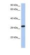 Capping Actin Protein Of Muscle Z-Line Subunit Alpha 3 antibody, NBP1-56416, Novus Biologicals, Western Blot image 