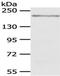 KDM6B antibody, TA350753, Origene, Western Blot image 
