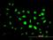 PHD Finger Protein 1 antibody, H00005252-M04, Novus Biologicals, Immunofluorescence image 