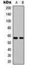 C-X-C Motif Chemokine Receptor 5 antibody, LS-C358998, Lifespan Biosciences, Western Blot image 