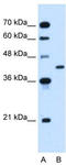 Glutamic-Oxaloacetic Transaminase 2 antibody, TA332131, Origene, Western Blot image 