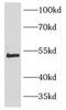 TNF Receptor Superfamily Member 10d antibody, FNab02271, FineTest, Western Blot image 