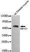 SET And MYND Domain Containing 1 antibody, M07134, Boster Biological Technology, Western Blot image 