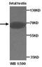 Four And A Half LIM Domains 1 antibody, orb78468, Biorbyt, Western Blot image 