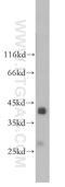 Gamma-sarcoglycan antibody, 18102-1-AP, Proteintech Group, Western Blot image 