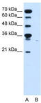 Solute carrier family 22 member 7 antibody, TA329509, Origene, Western Blot image 