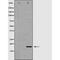 Ribonuclease A Family Member 13 (Inactive) antibody, orb228353, Biorbyt, Western Blot image 