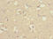 Neuronal acetylcholine receptor subunit alpha-6 antibody, LS-C675533, Lifespan Biosciences, Immunohistochemistry paraffin image 