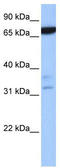 Zinc Finger And BTB Domain Containing 46 antibody, TA339759, Origene, Western Blot image 