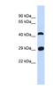 Cilia And Flagella Associated Protein 299 antibody, NBP1-56792, Novus Biologicals, Western Blot image 