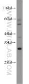 Tetraspanin 13 antibody, 18974-1-AP, Proteintech Group, Western Blot image 