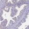 Sarcalumenin antibody, HPA045520, Atlas Antibodies, Immunohistochemistry paraffin image 