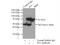Plasminogen Activator, Tissue Type antibody, 10147-1-AP, Proteintech Group, Immunoprecipitation image 