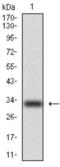 Keratin 5 antibody, abx011780, Abbexa, Western Blot image 