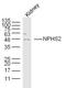 NPHS2 Stomatin Family Member, Podocin antibody, GTX00821, GeneTex, Western Blot image 