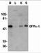 GDNF family receptor alpha-1 antibody, 1133, ProSci Inc, Western Blot image 