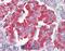 Solute Carrier Family 18 Member A2 antibody, 45-146, ProSci, Western Blot image 