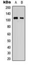 Kinase suppressor of Ras 1 antibody, LS-C358791, Lifespan Biosciences, Western Blot image 