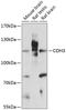 Cadherin 3 antibody, A03353, Boster Biological Technology, Western Blot image 