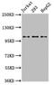 Kinesin Family Member 5B antibody, CSB-PA012342LA01HU, Cusabio, Western Blot image 