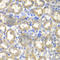Had antibody, A1076, ABclonal Technology, Immunohistochemistry paraffin image 