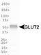 Solute carrier family 2, facilitated glucose transporter member 2 antibody, TA336933, Origene, Western Blot image 