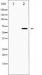 M-phase inducer phosphatase 2 antibody, TA325329, Origene, Western Blot image 