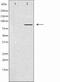 Chloride Voltage-Gated Channel 7 antibody, GTX00807, GeneTex, Western Blot image 