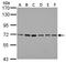 Protein Arginine Methyltransferase 5 antibody, GTX628488, GeneTex, Western Blot image 