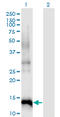 Cyclin-dependent kinase 4 inhibitor B antibody, LS-C196887, Lifespan Biosciences, Western Blot image 