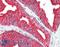 Gremlin-2 antibody, LS-C311195, Lifespan Biosciences, Immunohistochemistry paraffin image 