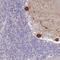 CYLD Lysine 63 Deubiquitinase antibody, HPA050095, Atlas Antibodies, Immunohistochemistry frozen image 