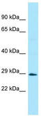 Signal Transducing Adaptor Family Member 1 antibody, TA331361, Origene, Western Blot image 