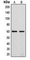 Cytochrome P450 Family 4 Subfamily F Member 2 antibody, MBS821628, MyBioSource, Western Blot image 