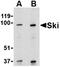 SKI Proto-Oncogene antibody, orb74408, Biorbyt, Western Blot image 