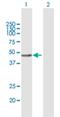 Vacuolar Protein Sorting 36 Homolog antibody, H00051028-B01P, Novus Biologicals, Western Blot image 