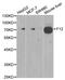 Coagulation Factor XII antibody, MBS127609, MyBioSource, Western Blot image 
