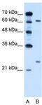 Nuclear receptor ROR-alpha antibody, TA338251, Origene, Western Blot image 