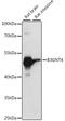 UDP-GlcNAc:BetaGal Beta-1,3-N-Acetylglucosaminyltransferase 4 antibody, A15896, ABclonal Technology, Western Blot image 