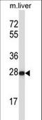 Helt BHLH Transcription Factor antibody, LS-C166835, Lifespan Biosciences, Western Blot image 