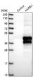 Harbinger Transposase Derived 1 antibody, NBP1-88384, Novus Biologicals, Western Blot image 
