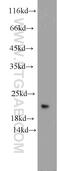 Ubiquitin-Fold Modifier Conjugating Enzyme 1 antibody, 15783-1-AP, Proteintech Group, Western Blot image 