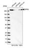 Glutamyl-Prolyl-TRNA Synthetase antibody, HPA026490, Atlas Antibodies, Western Blot image 