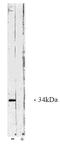Protein Phosphatase 4 Catalytic Subunit antibody, AP05056PU-N, Origene, Western Blot image 