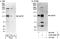 Discs Large MAGUK Scaffold Protein 1 antibody, A302-226A, Bethyl Labs, Immunoprecipitation image 