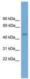 Forkhead Box D4 antibody, TA341764, Origene, Western Blot image 